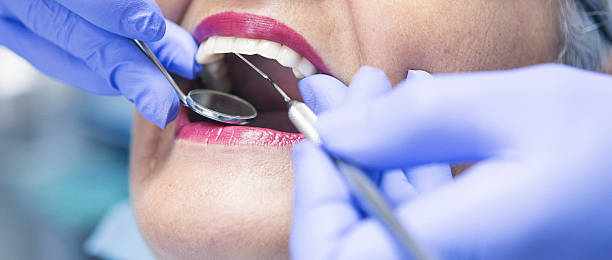 Best Emergency Dental Care for Broken or Chipped Teeth in St James, MN